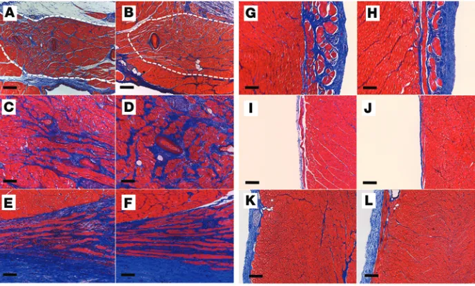 Figure 3. Cardiac structural evaluation of SCN5Asections from the sinoatrial node (FE558X/+ pigs