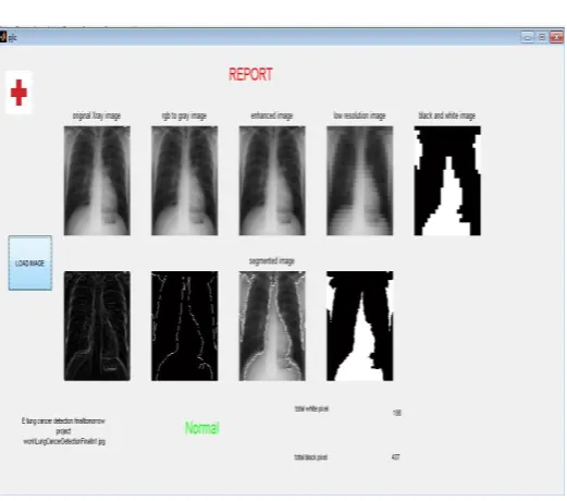Fig 5.1result for detected image  