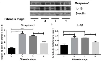 Figure 3. using Image J. C: Tobserved at different fibrosis stages of NASHliver fibrosis stages by The expressions of caspase-1 and IL-1β both increased to peak at stage 2 of liver fibrosis of NASH and remained high level at stage 3, but decreased signific