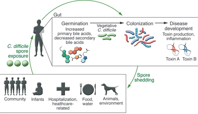 Figure 1. cDi pathogenesis. Development of dis-ease, particularly in a healthy individual