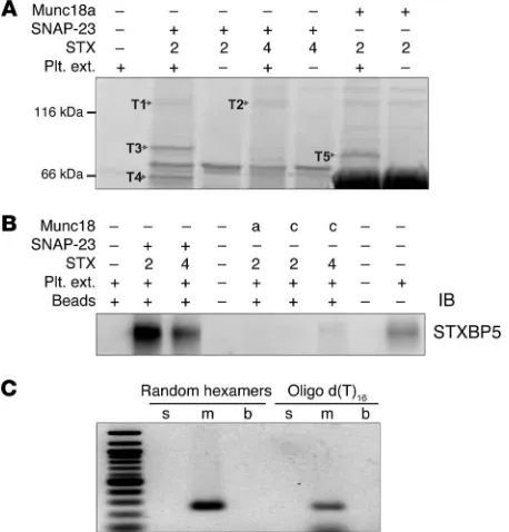 Figure 1. STXBP5 is present in human platelets. (A) The indicated com-plexes were produced in E