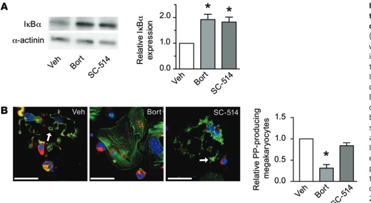 Figure 3. Proteasome-dependent forma-tion of proplatelets in human megakaryo-