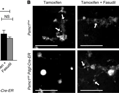 Figure 7. Genetic deletion of Psmc1(relative to proplatelet-producing megakaryocytes was quantified and expressed relative to  in megakaryocytes is associated with increased RhoA protein and activity