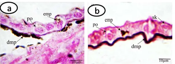 Figure 10. Sections of the tail skin of Bufo regularis tadpoles (a) Stage 44 showing epidermis and collagen layer, (b) Stage 64 showing break down and disintegration epithelial layer, as well as disappearance of the collagenous layer underneath the epiderm