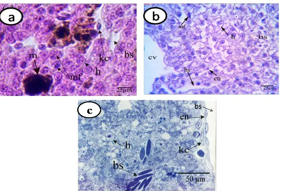 Figure 2. Sections and semithin sections of the liver of Buforegularis tad-poles showing (a) stage 48, (b), (c) and (d) stage 52, apoptotic nuclei (ap), apoptotic body (ab), dilated blood sinusoids (bs), endothelial cells (en), he-patocytes (h), kupffer ce