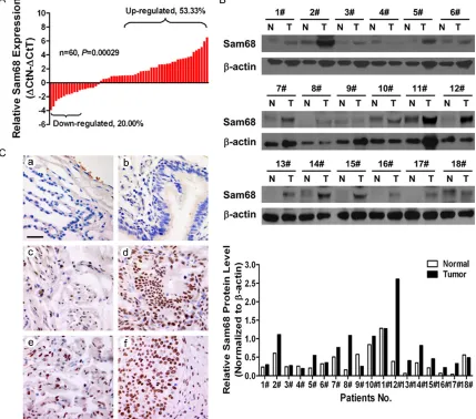 Figure 1. The expression of Sam68 is upregulated in NSCLC tissues. A. Determination of Sam68 mRNA level by bepression of Sam68 was decreased in NSCLC tissues