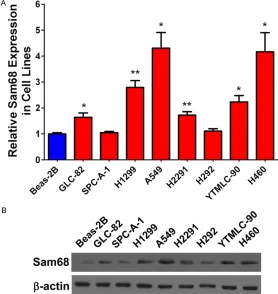 Figure 2. Higher Sam68 expression predicts worse overall survival. A. Kaplan-Meier analysis of the correlation be-tween Sam68 and overall survival of the LC patients using the data from KM plotter (n=1926, http://www.kmplot.com)