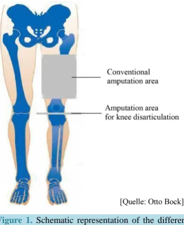 Figure 1. Schematic representation of the different amputation levels.                                        