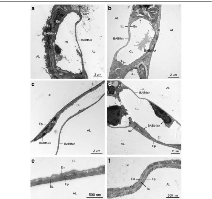 Fig. 5 Electron micrographs of interalveolar septum. (a) control group; (b) ischaemia group; (c) aEVLP group; (d) cEVLP group