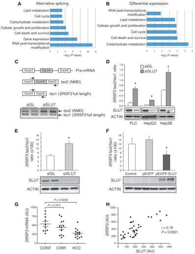 Figure 1SLU7analysis of  strongly influences the gene expression profile of human liver cell lines and modulates SRSF3 splicing
