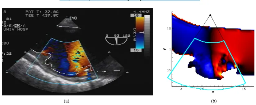 Figure 15. Two-dimensional ultrasonic-measurement-integra- ted (2D-UMI) blood flow analysis system