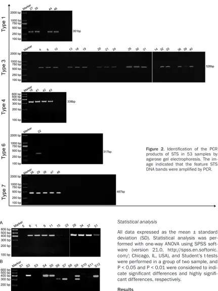 Figure 2. Identification of the PCR products of STS in 53 samples by 