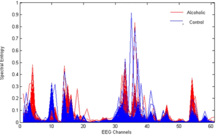 Fig. 2 Spectral entropy plot of a single alcoholic/control subject