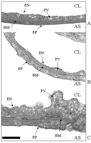 Fig. 3 shows the protein distribution in the detergent resistant fractions after 3 h of hypoxia