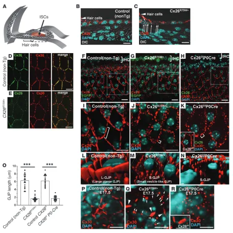 Figure 1Drastic disruption of cochlear GJPs in two models of CX26-associated deafness