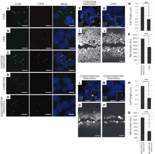 Figure 4Disruption of cochlear GJPs is reproduced by human cDNA clones for CX30 and CX26, with or without mutations in HeLa cells, and leads to 