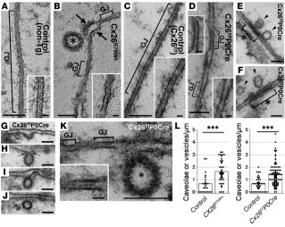 Figure 6Discontinuous gap junctions with excessive endocytosis in CX26-mutant mice. (