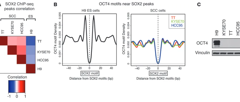 Figure 1SOX2 genomic occupancy in SCC cells is distinct from that in ES cells. (A) Correlation matrix depicting pairwise comparisons of identified SOX2 binding peaks in the 3 SOX2-amplified SCC lines and in the ES cell line H9