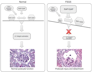 Figure 9Increased podocyte expression of RAP1GAP drives podocyte injury by preventing activation of β1 integrin