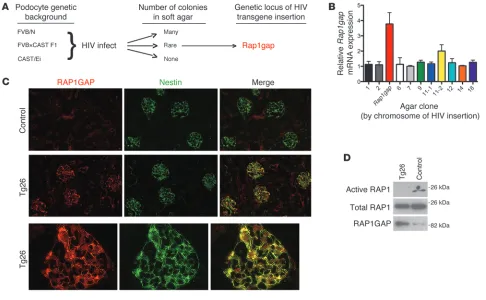 Figure 1Identification of cell lines from 3 different genetic backgrounds were generated, infected with HIV-1 provirus, and then grown in soft agar