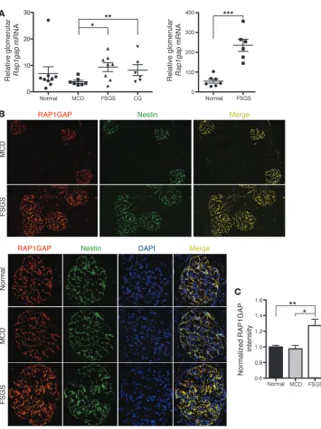 Figure 2RAP1GAP expression is increased in 