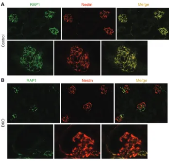 Figure 3Podocyte expression of RAP1 is lost 