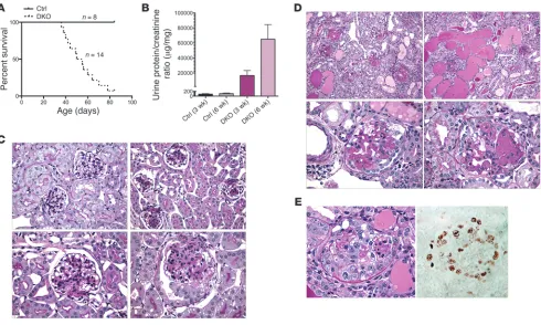 Figure 4Podocyte-specific inactivation of both 