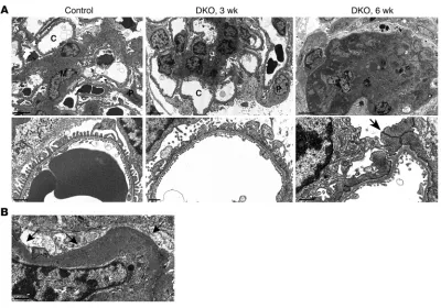 Figure 5Electron micrographic studies of DKO mice, showing time course and extent of podocyte dysfunction