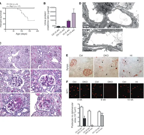 Figure 6Podocyte-specific 