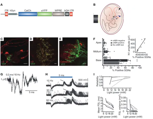 Figure 8AAV2/6-mediated expression of CatCh renders murine SGNs light sensitive. (