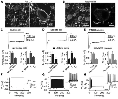 Figure 9Photoresponses of auditory brainstem neurons in vitro. (A and B) Fluorescent images of principal cells stained for GFP to localize ChR2 expres-sion in the cochlear nucleus and MNTB, respectively