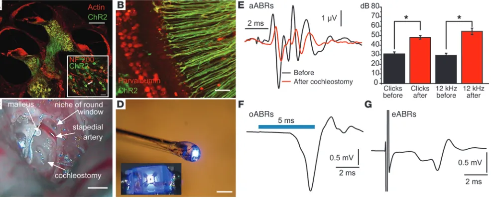 Figure 1Optical activation of the auditory pathway in 