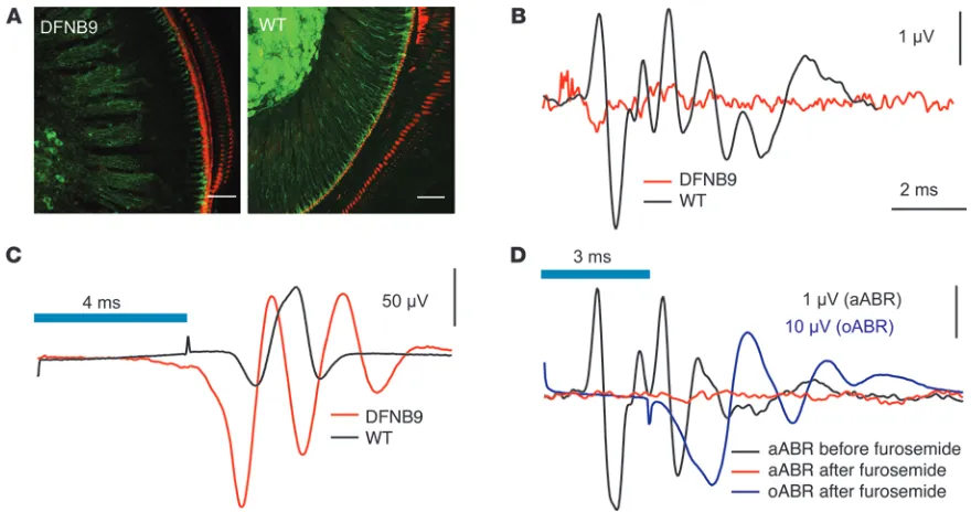 Figure 7Cochlear optogenetics restores auditory activity in deaf mice. (A) Maximum projection of confocal sections of apical cochlear coils from ChR2-pos-
