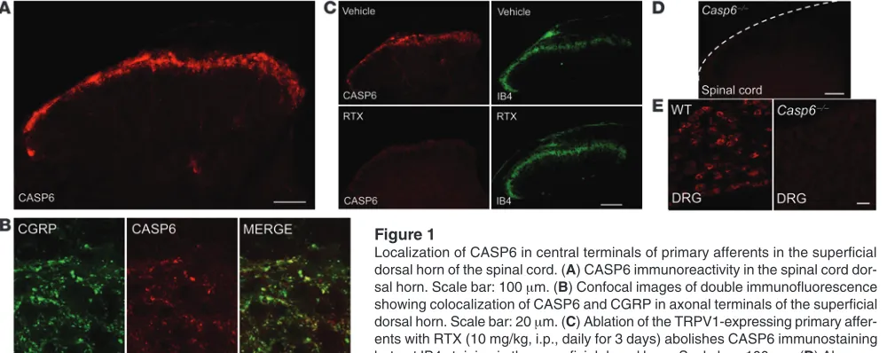 Figure 1Localization of CASP6 in central terminals of primary afferents in the superficial dorsal horn of the spinal cord