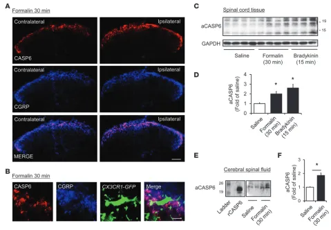 Figure 2Upregulation of CASP6 in the spinal cord and CSF after acute inflammation. (A) Double staining of CASP6 and CGRP in the ipsilateral and 