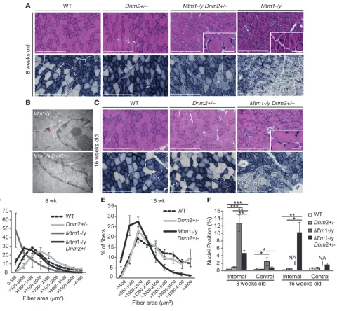 Figure 3CNM histological features are greatly rescued in this age. All graphs depict mean ± SEM