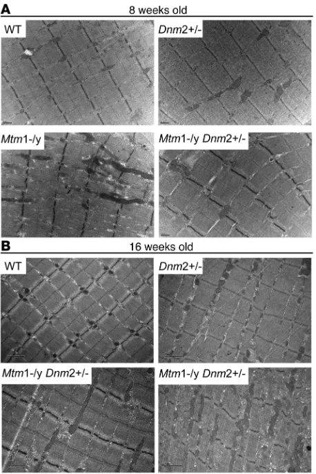 Figure 5Improved muscle ultrastructure of 