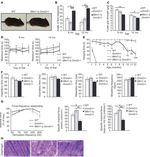 Figure 7Long-term phenotype of Mtm1–/y mice with reduced DNM2 expression. (A) 12-month-old WT (left) and Mtm1–/yDnm2+/– (right) mice