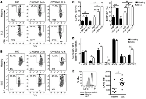 Figure 2Increased GSL expression is associated with defective GSL homeostasis in T cells from SLE patients