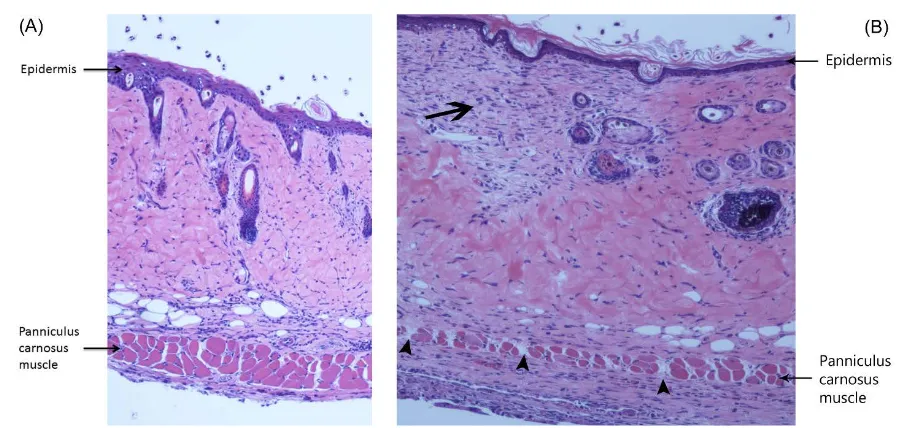 Figure 3. Flap histopathology. (A) Photomicrograph of the distal region of a porous implant flap at Day 10