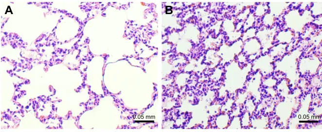 Figure 3 Microscopic examination of lung tissue in guinea pigs exposed to smoke (study group) and air (control group).Notes: h&e staining was used