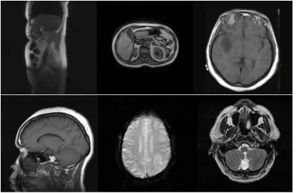 Fig 4: Examples of MRI images from TCIA database  