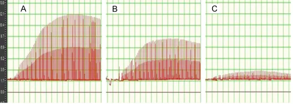 Table 2. Oxidative stress in diaphragm and diaphragmatic contrac-tility in each group