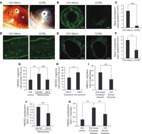 Figure 1Effect of pigmented and nonpigmented melanocytes on angiogenesis. (