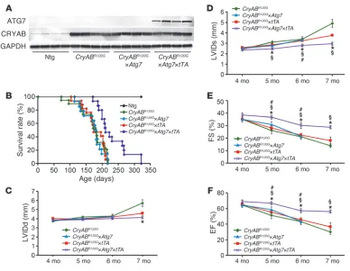 Figure 7Cardiac hemodynamics in §CryABR120G×Atg7×tTA mice. (A) Western blot showing ATG7 and CRYAB expression in Ntg, CryABR120G, CryABR120G×Atg7, and CryABR120G×Atg7×tTA mice