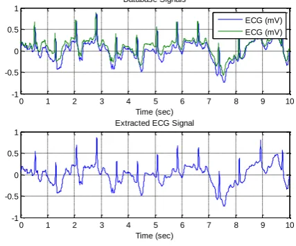 Fig (d): Extraction of ECG signal  