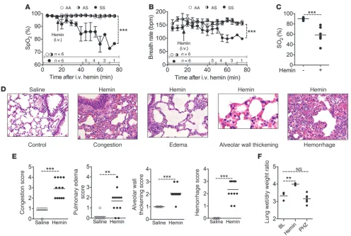 Figure 2SS mice with EHC develop ALI. (hemin (A) SpO2 and (B) breath rate, as determined by pulse oximetry, in SS mice and control animals challenged with n = 6)