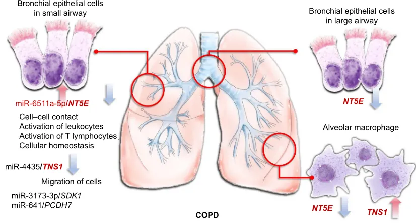 Figure 6 gene expression Omnibus database analysis of the four genes downregulated in COPD small airway, large airway, and alveolar macrophages.Notes: The four downregulated gene with potential microrna–mrna interactions validated in the gse4498 database (