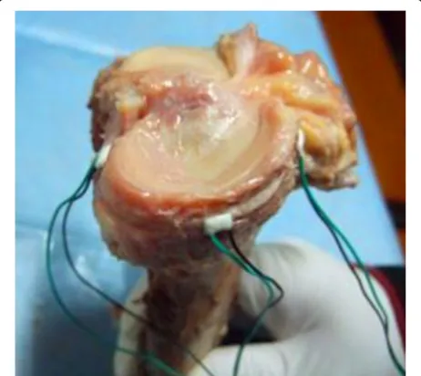 Fig. 1 The installment of strain gages at anterior, middle, and posteriorpart of the medial tibial plateau