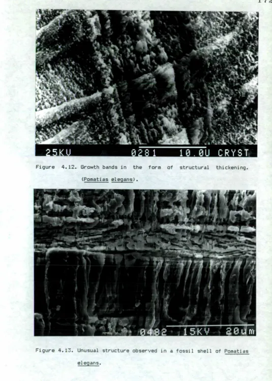 Figure 4.12. Growth bands in the form of structural thickening.